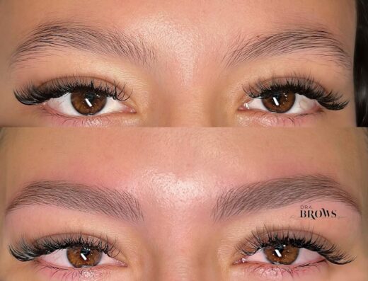 Dra. Brows