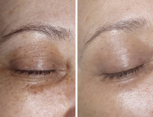 Derma Skin Esthetic